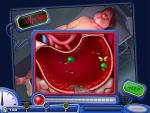Operation Mania notch